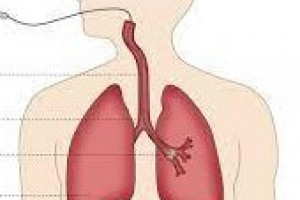 افزایش آمار سرطان در ایران/ آلودگی هوا عامل سرطان «ریه» و «مثانه»